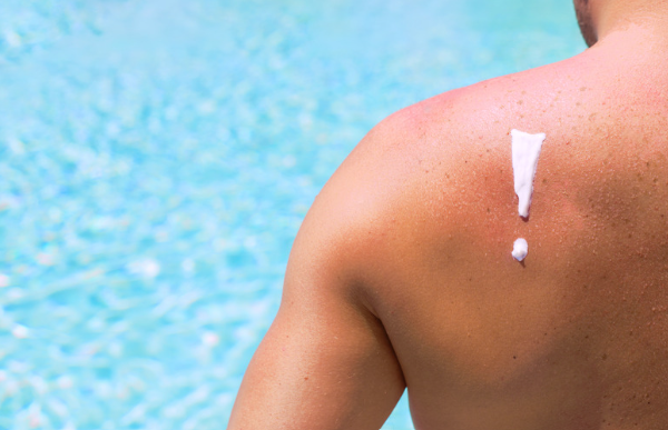 Differences Between Sunburn, Sun Poisoning, Heat Rash, Heat Exhaustion