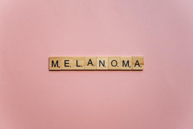 ABCDE melanoma assessment for skin cancer